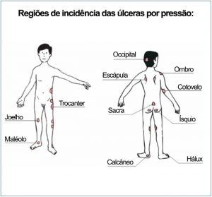 regiores-de-incidencia