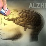 NEP INFORMA: Doença de Alzheimer